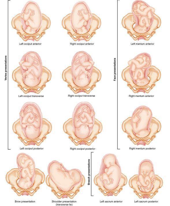 Fetal Positions Before Birth.